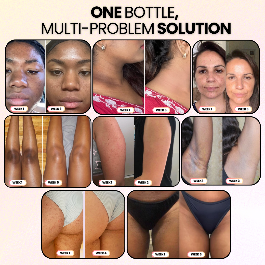 Peel Shot | Kojic + Turmeric Body Spray