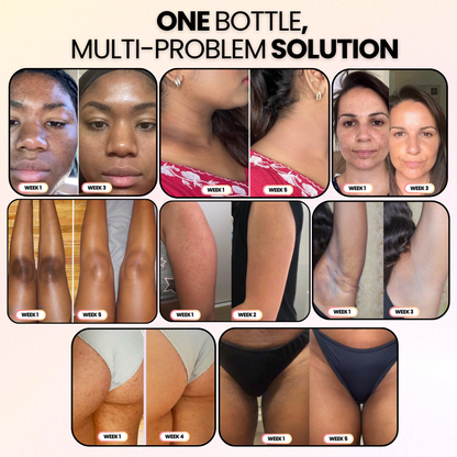 Peel Shot | Kojic + Turmeric Body Spray